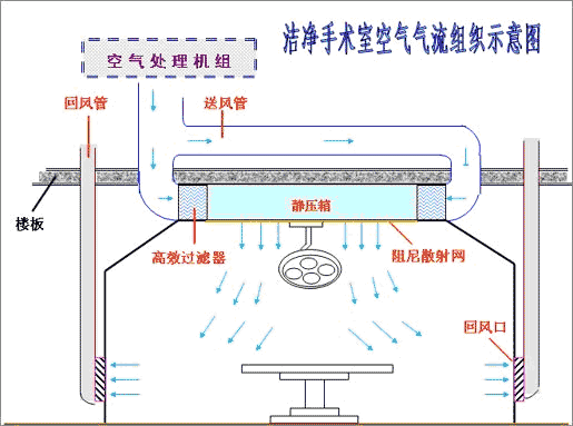 潔凈手術(shù)室氣流組織示意圖